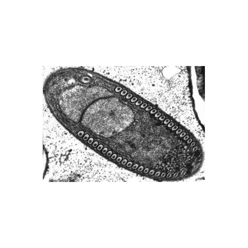 Červi a Mikrosporidie