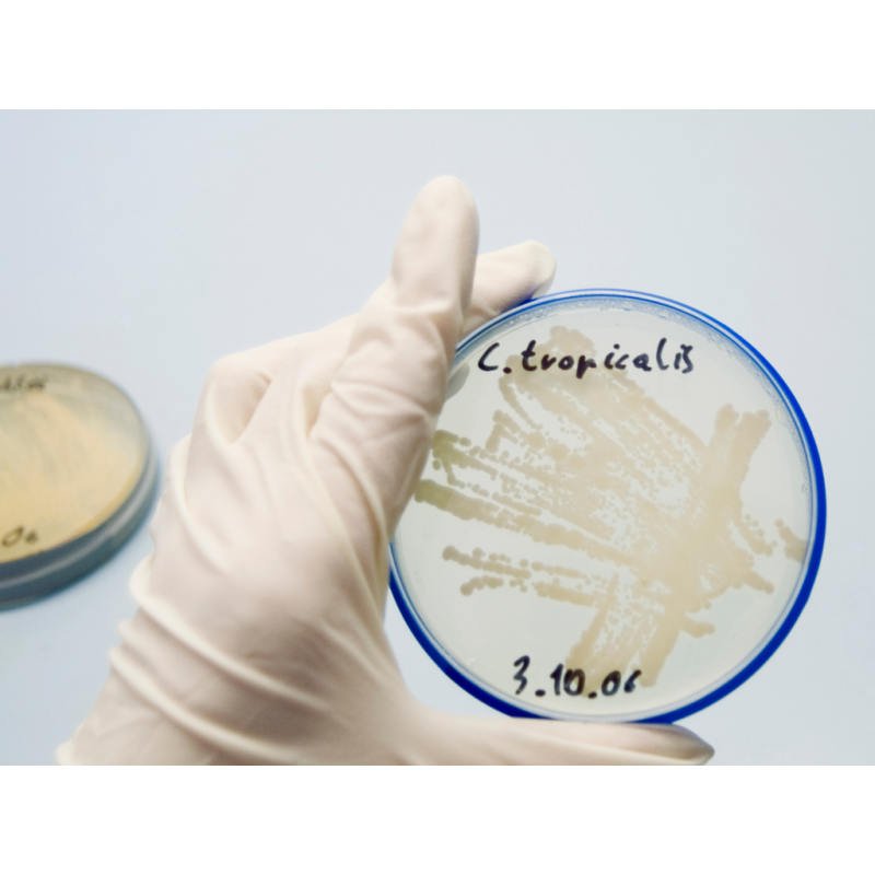 Mycobiom - Kompletní vyšetření kvasinek ze stolice